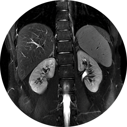 Abdominal Imaging icon