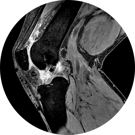 Musculoskeletal Imaging icon