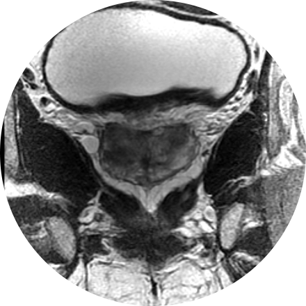 Prostate Imaging icon