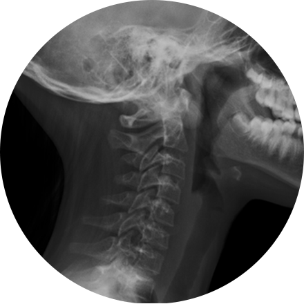 Digital X-ray icon