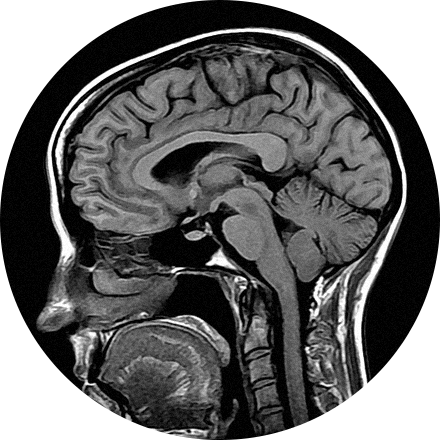 MRI icon