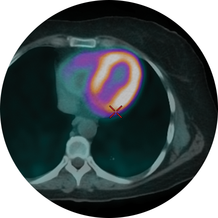 PET/CT icon